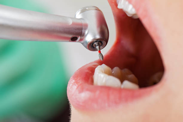 Best Knocked-Out Tooth Emergency  in Walker Valley, NY